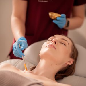 Anti-Blemish Peel- Dermaquest
