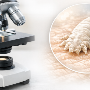 Badanie diagnostyczne Demodex (w kierunku obecności nużeńca)